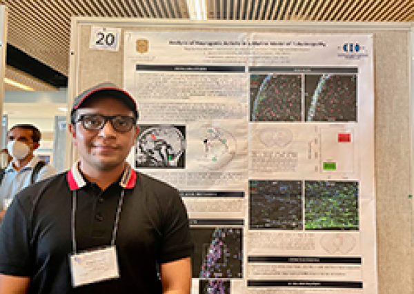 Estudiante de la UG presenta proyecto de procesos neurodegenerativos en “Gordon Research Conferences” 