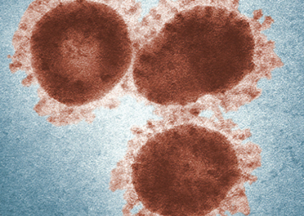 México cuenta con buen soporte para el diagnóstico del coronavirus: experto UG