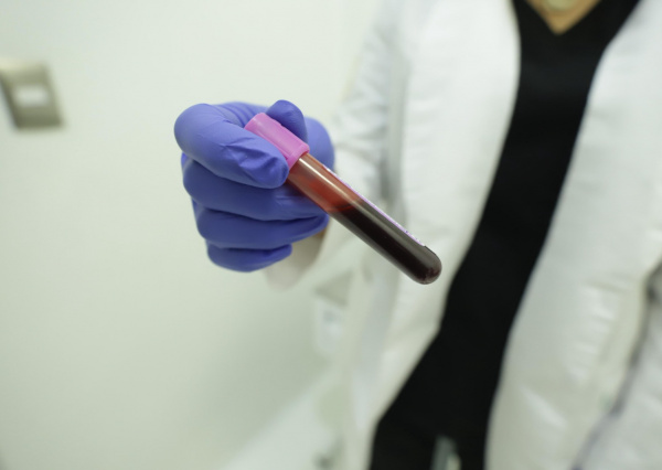 Con costos accesibles, LUDIMUG extiende sus servicios de análisis clínicos a la comunidad en general